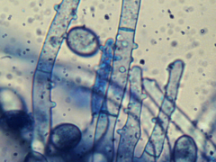 Botryobasidium conspersum