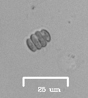 Scenedesmus