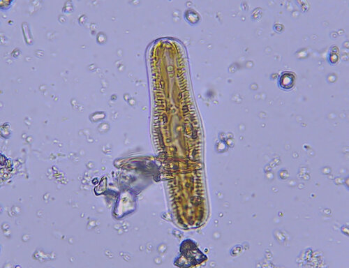 iNaturalist observation photo of Epithemia gibba