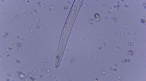 iNaturalist observation photo of Nematodes
