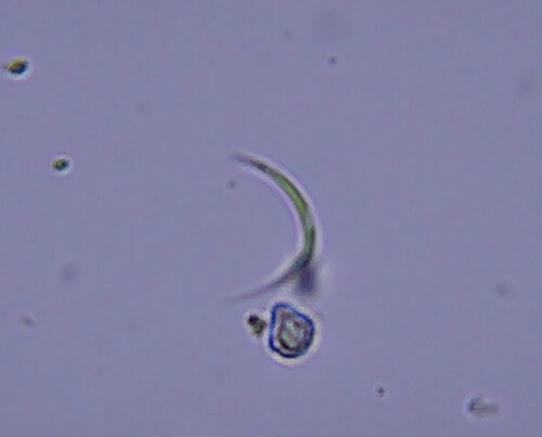 iNaturalist observation photo of Monoraphidium arcuatum