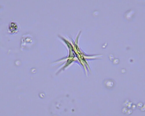 iNaturalist observation photo of Ankistrodesmus fusiformis