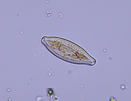 iNaturalist observation photo of Cymbellales