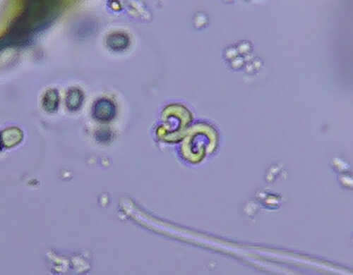 iNaturalist observation photo of Raphidocelis