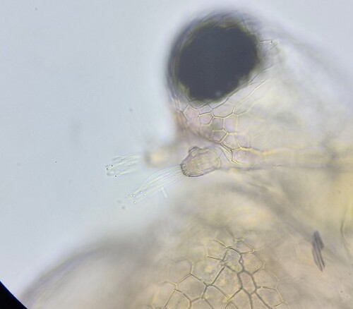 Ceriodaphnia reticulata