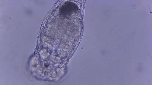 iNaturalist observation photo of Rotifers