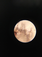 Otodectes cynotis
