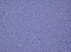 Mycobacterium gordonae