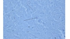 Mycobacterium gordonae