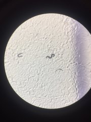 Caenorhabditis elegans