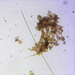 Phormidium autumnale