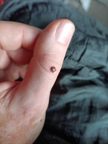 Ornate Cow Tick