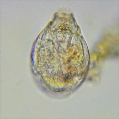 Lecane closterocerca