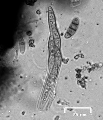 Hysterium angustatum