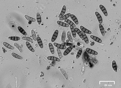 Hysterium angustatum