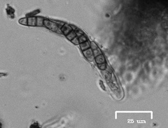 Hysterium angustatum