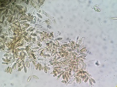 Hysterangium separabile