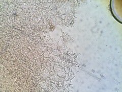 Hysterangium separabile