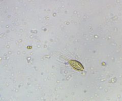 Mallomonas caudata