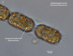 Eupyxidicula turris