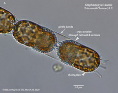 Eupyxidicula turris