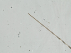 Planktothrix