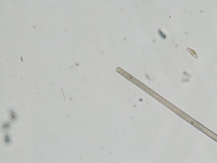 Planktothrix