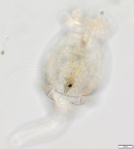 Brachionus angularis