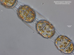 Stephanopyxis nipponica