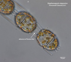 Stephanopyxis nipponica