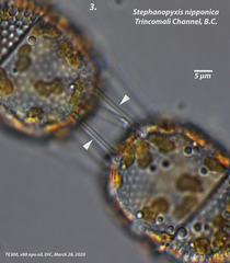 Stephanopyxis nipponica