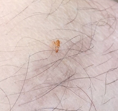 Pseudomyrmex simplex