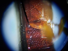 Corticeus thoracicus