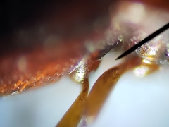 Corticeus thoracicus