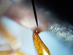 Corticeus thoracicus