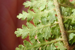 Anemia vestita