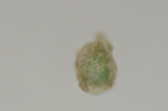 Pseudephebe pubescens