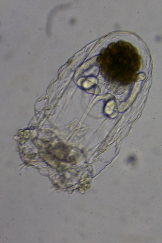 Asplanchna