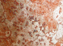 Arthonia rubrocincta