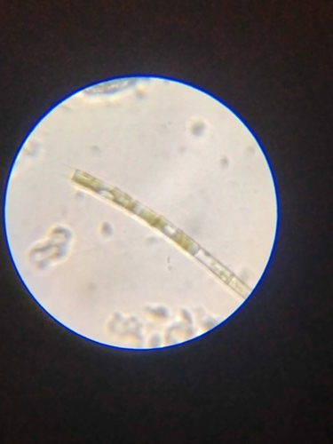 Aulacoseira granulata