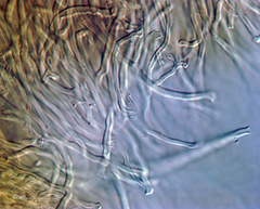 Steccherinum resupinatum