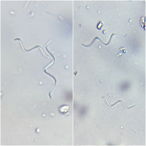 Spirulina observed 2026-08-21