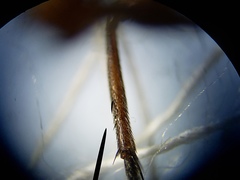 Oxysarcodexia ventricosa