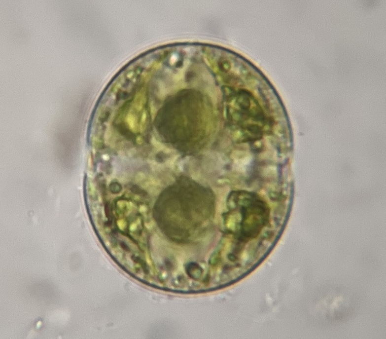 Actinotaenium wollei