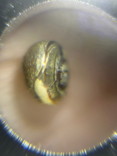 Cepaea