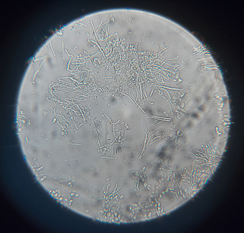Dimerella lutea image
