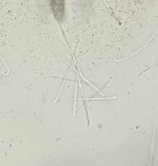 Coccomyces triangularis