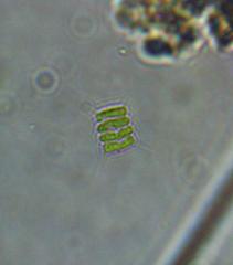 Scenedesmus quadricauda