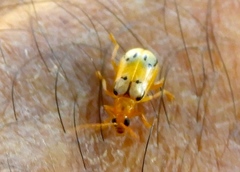 Diabrotica litterata