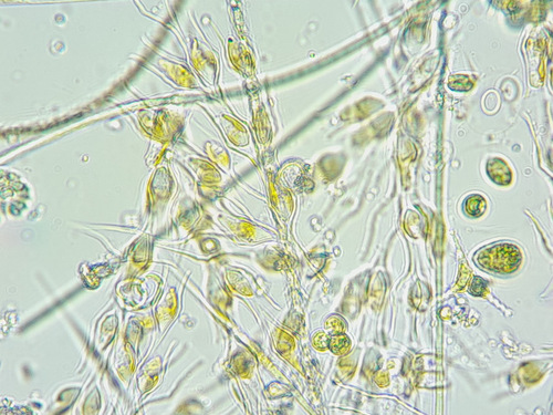 Dinobryon divergens